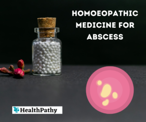 homeopathic medicine for abscess