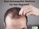 Best Homeopathic Medicine for Hair Regrowth